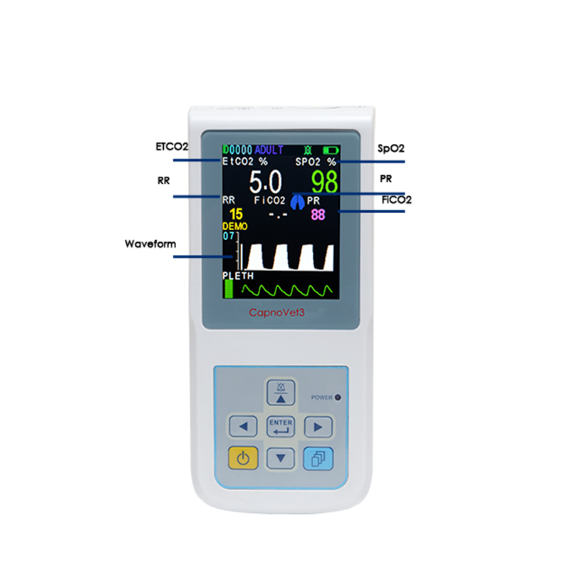 CapnoVet3 Veterinary Capnograph Monitor and Pulse Oximeter - 图片 3